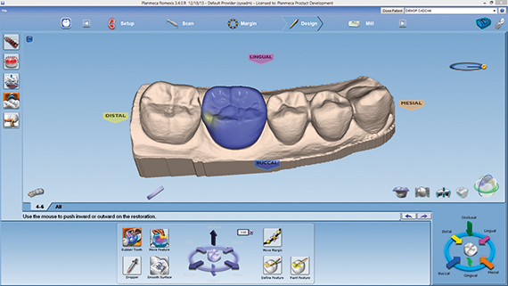 普兰梅卡 CAD/CAM 椅旁设计软件 PlanCAD 普兰梅卡 CAD/CAM 椅旁设计软件 PlanCAD