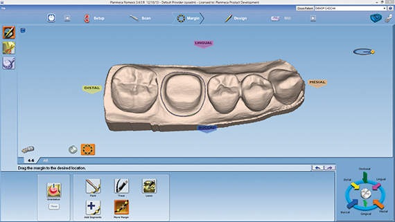 普兰梅卡 CAD/CAM 椅旁设计软件 PlanCAD 普兰梅卡 CAD/CAM 椅旁设计软件 PlanCAD