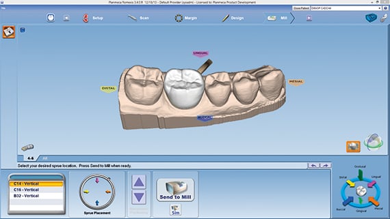 普兰梅卡 CAD/CAM 椅旁设计软件 PlanCAD 普兰梅卡 CAD/CAM 椅旁设计软件 PlanCAD