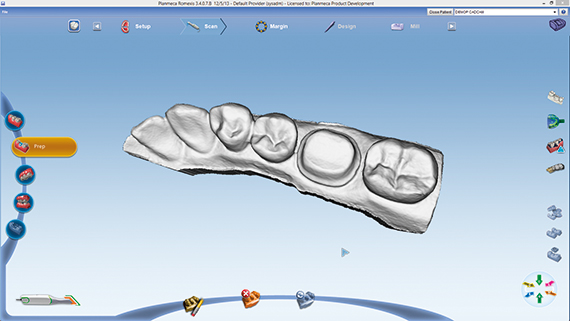 普兰梅卡 CAD/CAM 椅旁设计软件 PlanCAD 普兰梅卡 CAD/CAM 椅旁设计软件 PlanCAD