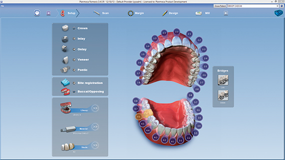 普兰梅卡 CAD/CAM 椅旁设计软件 PlanCAD 普兰梅卡 CAD/CAM 椅旁设计软件 PlanCAD