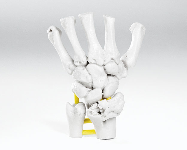 Planning model of patient's hand